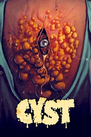 Киста (фильм, 2020)