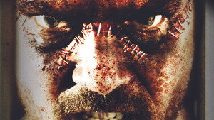 Синдром Франкенштейна (фильм, 2010)
