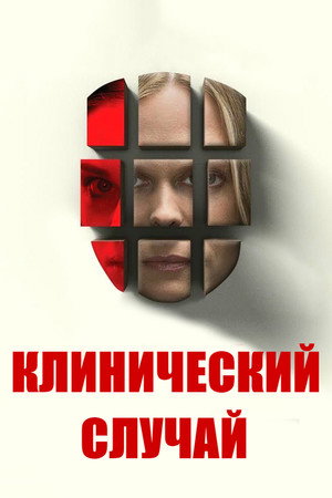 Клинический случай (фильм, 2017)